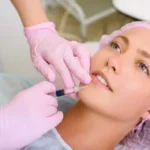 DERMAL FILLERS​